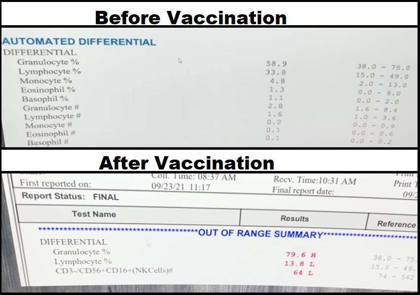 Coronavirus pandemic 2019-20 #3 - Page 35 Vaccine-Immunity-Impact-3-Before-and-After